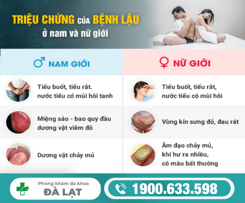 Hình ảnh minh họa